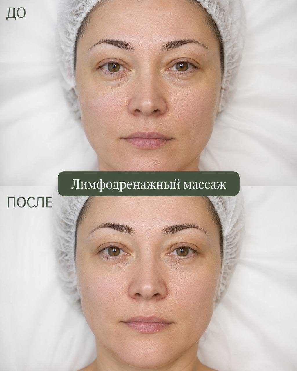 Лимфодренажный массаж — до и после, в Клинцах